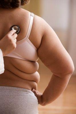 Fotografía que muestra a una mujer con obesidad.
