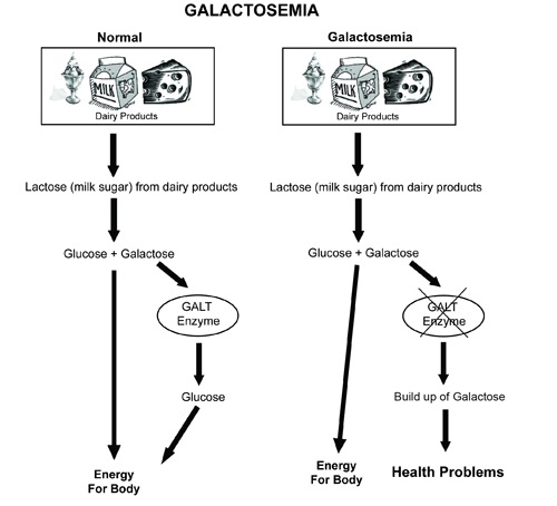 Comparación del metabolismo de la galactosa