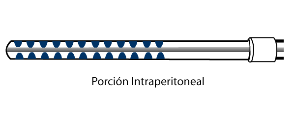 Porción intraperitoneal del catéter para DP