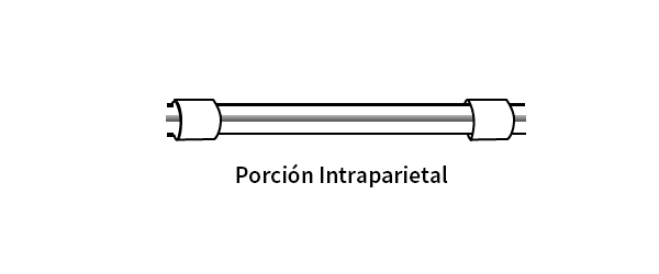 Porción intraparietal del catéter para DP
