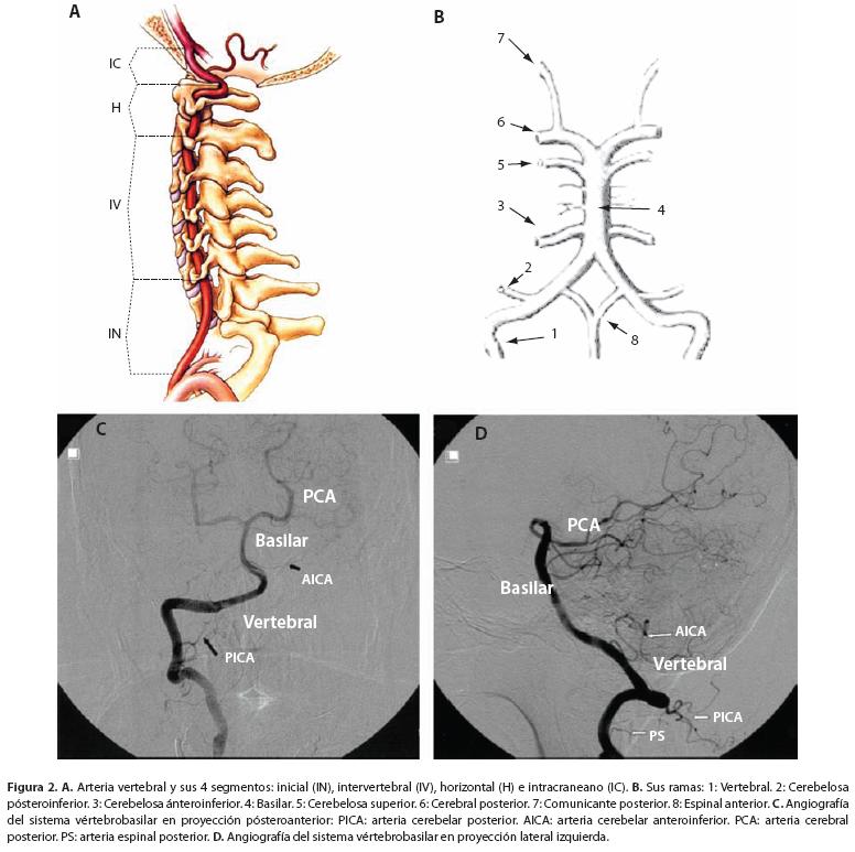 Sistema vértebro-basilar (Poveda, 2009)